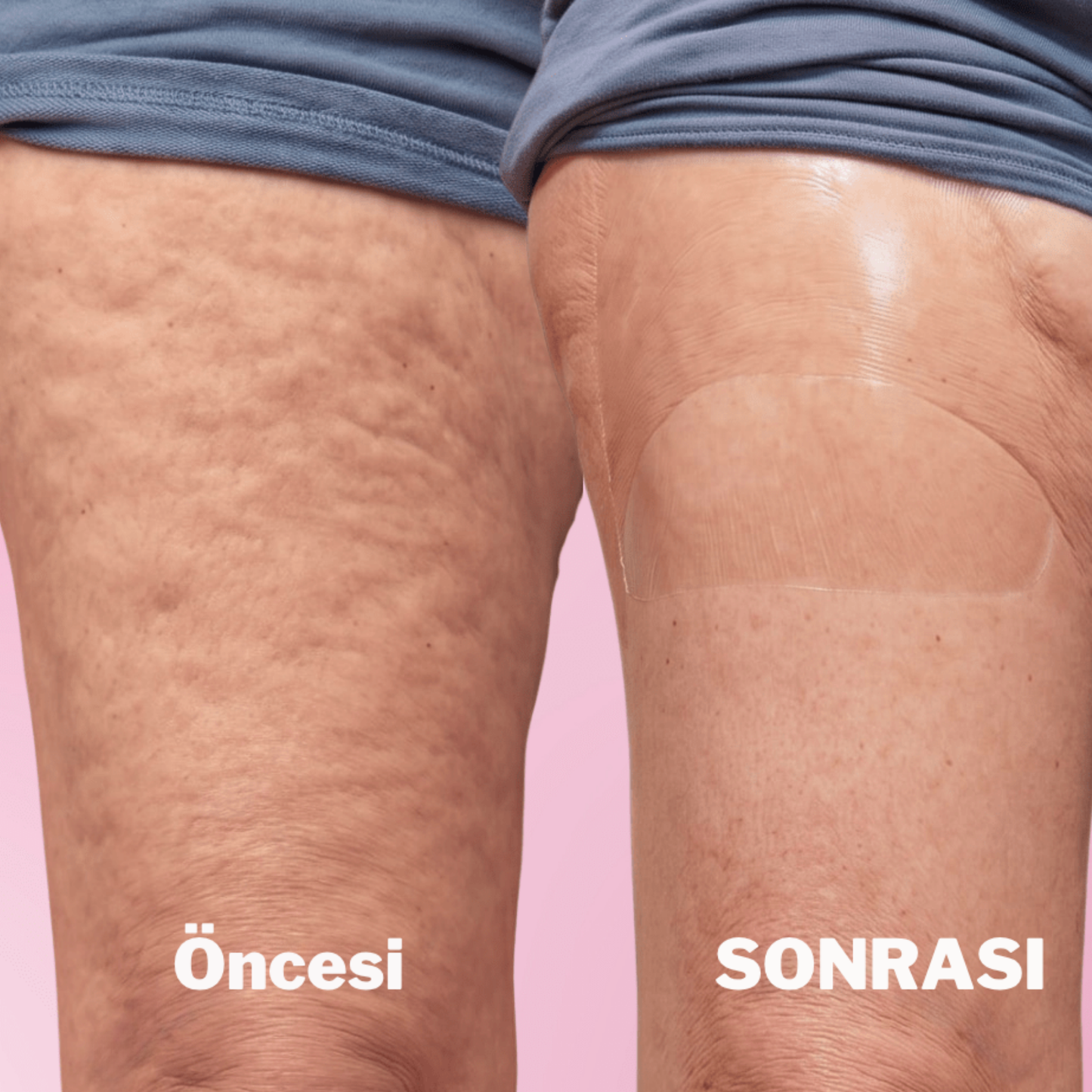 Bacakları ve Kalçaları Sıkılaştırma