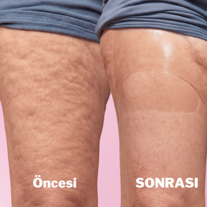 Bacakları ve Kalçaları Sıkılaştırma